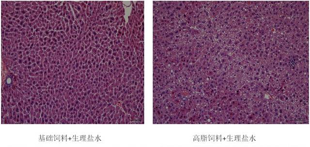 基于酸粥的高抗氧化和降胆固醇活性益生菌及应用